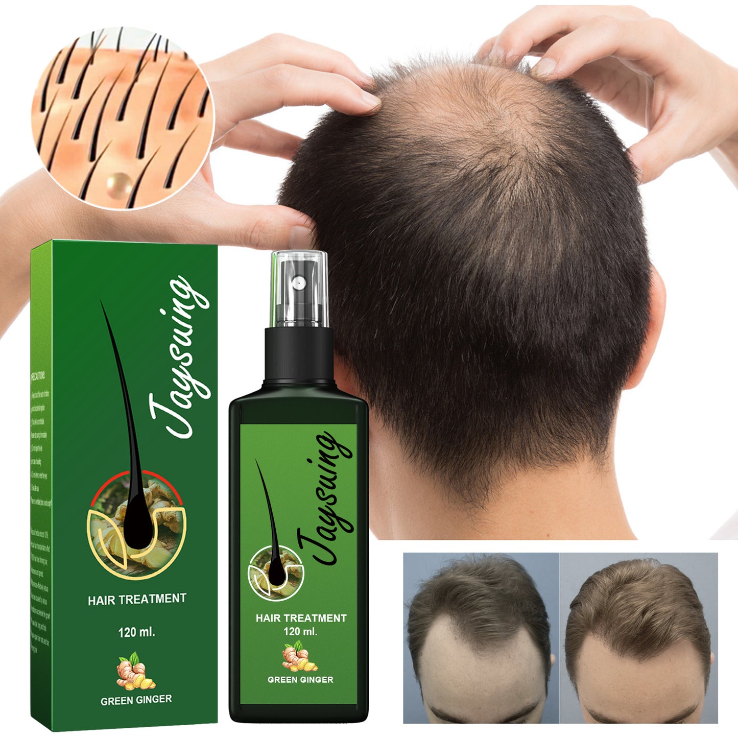 Jaysuing Hair Treatment, Strengthens Hair, Nourishes Root Growth And Thickens Scalp Massage Nutrient Solution